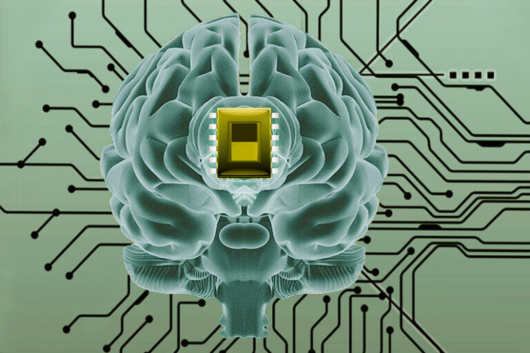 Implante de chips cerebrais foi aprovado para testes em humanos